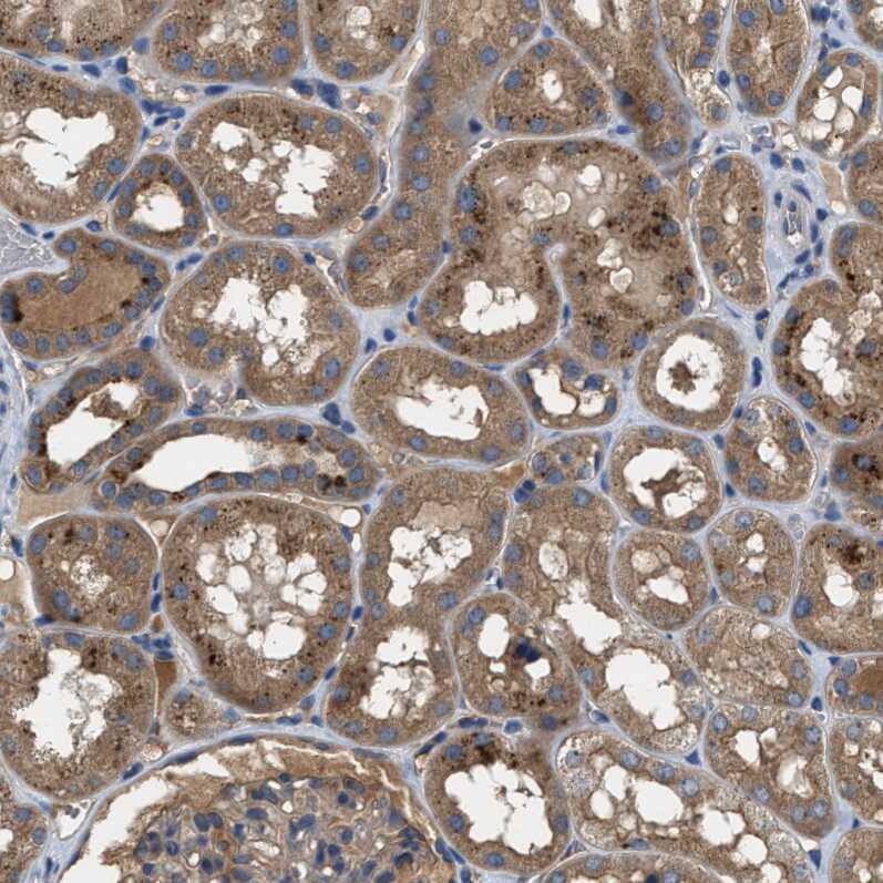 BLOC1S1 Antibody Immunohistochemistry-Paraffin: BLOC1S1 Antibody [NBP1-88583]