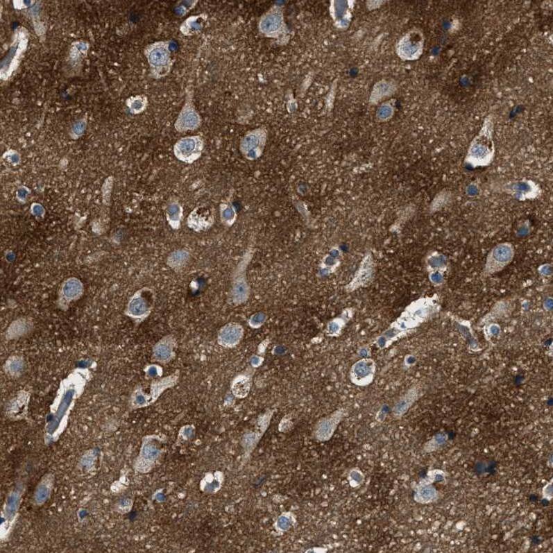 BLOC1S1 Antibody Immunohistochemistry-Paraffin: BLOC1S1 Antibody [NBP1-88583]