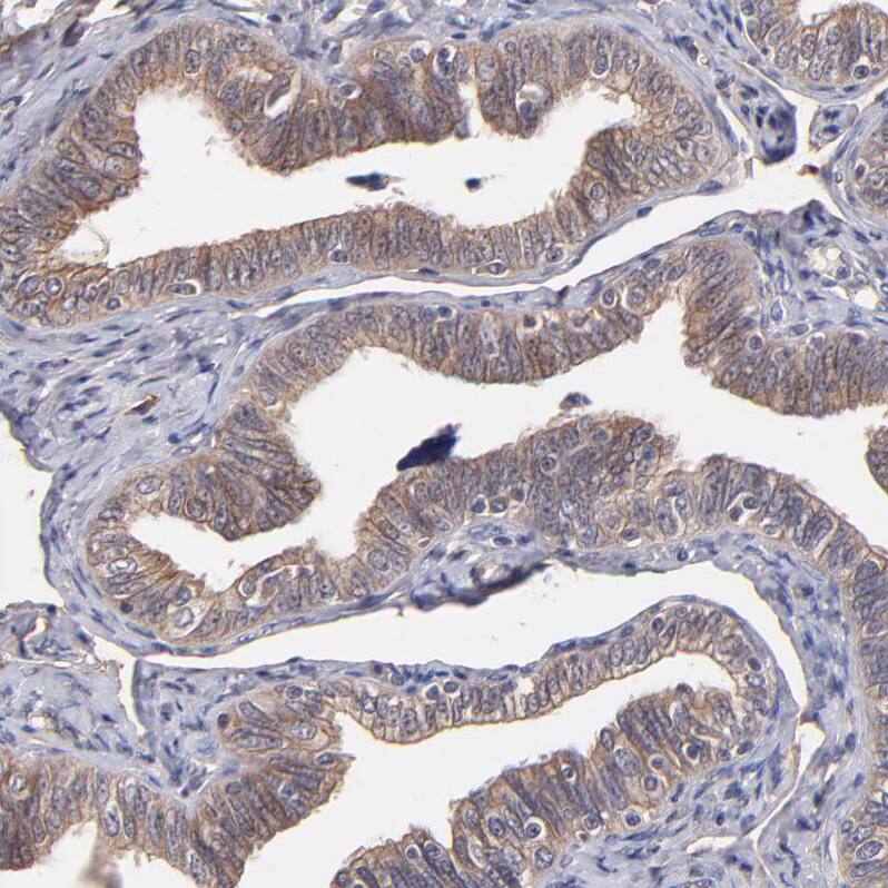 STAP2 Antibody - BSA Free Immunohistochemistry-Paraffin: STAP2 Antibody - BSA Free [NBP1-88586]
