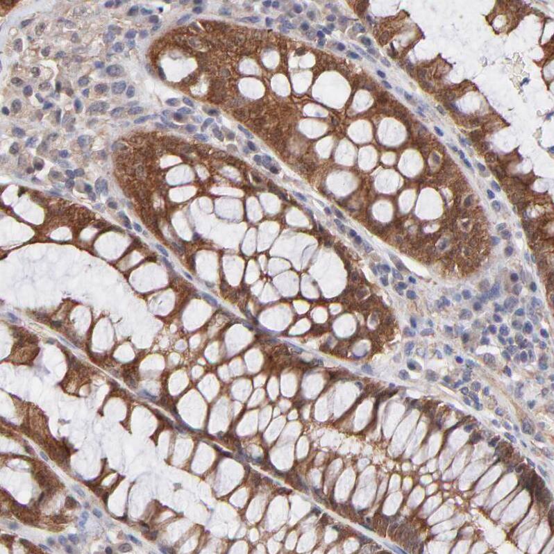 STAP2 Antibody - BSA Free Immunohistochemistry-Paraffin: STAP2 Antibody - BSA Free [NBP1-88586]