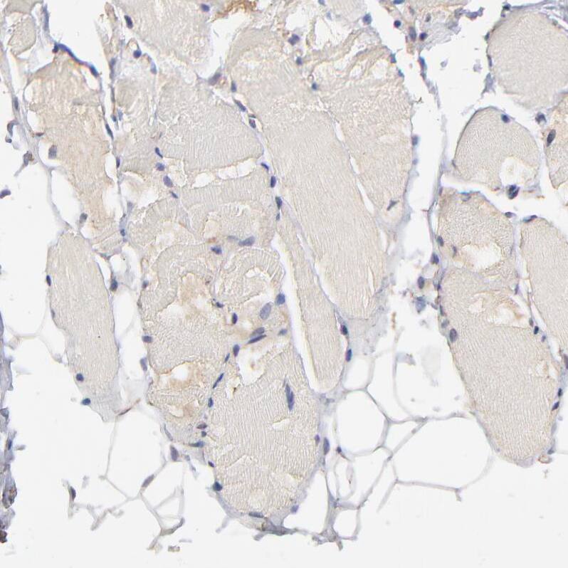 STAP2 Antibody - BSA Free Immunohistochemistry-Paraffin: STAP2 Antibody - BSA Free [NBP1-88586]