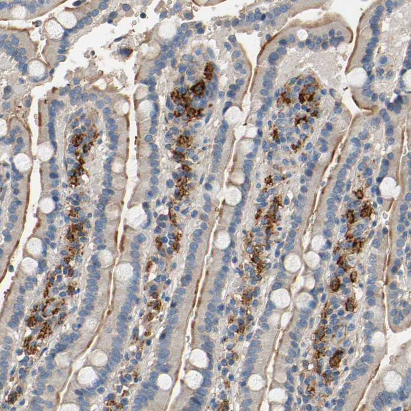 SUSD2 Antibody - BSA Free Immunohistochemistry-Paraffin: SUSD2 Antibody - BSA Free [NBP1-88589]