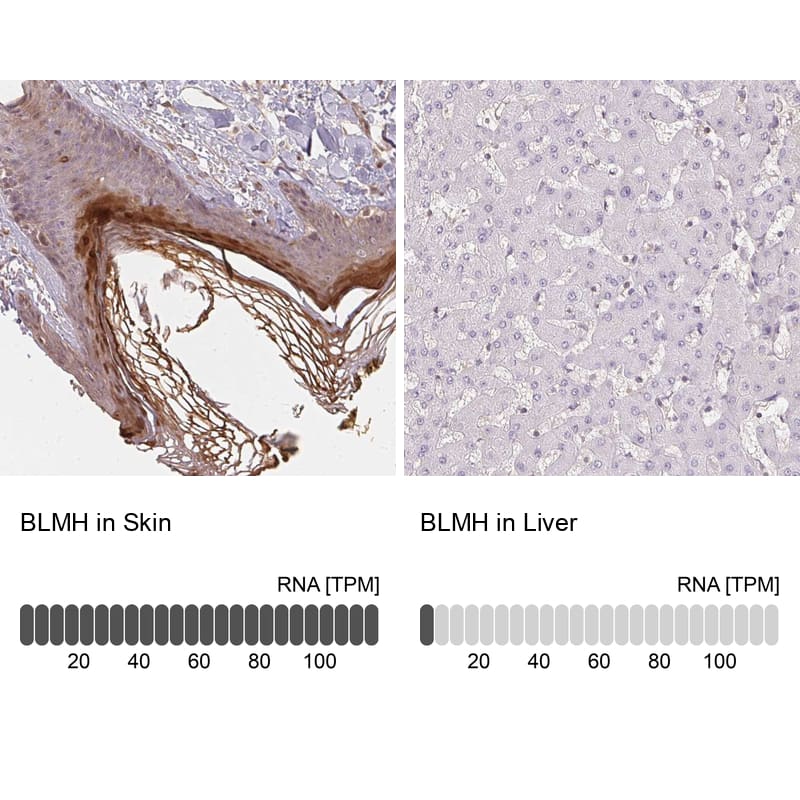 BLMH/Bleomycin Hydrolase Antibody - BSA Free Immunohistochemistry-Paraffin: BLMH/Bleomycin Hydrolase Antibody [NBP1-88640]