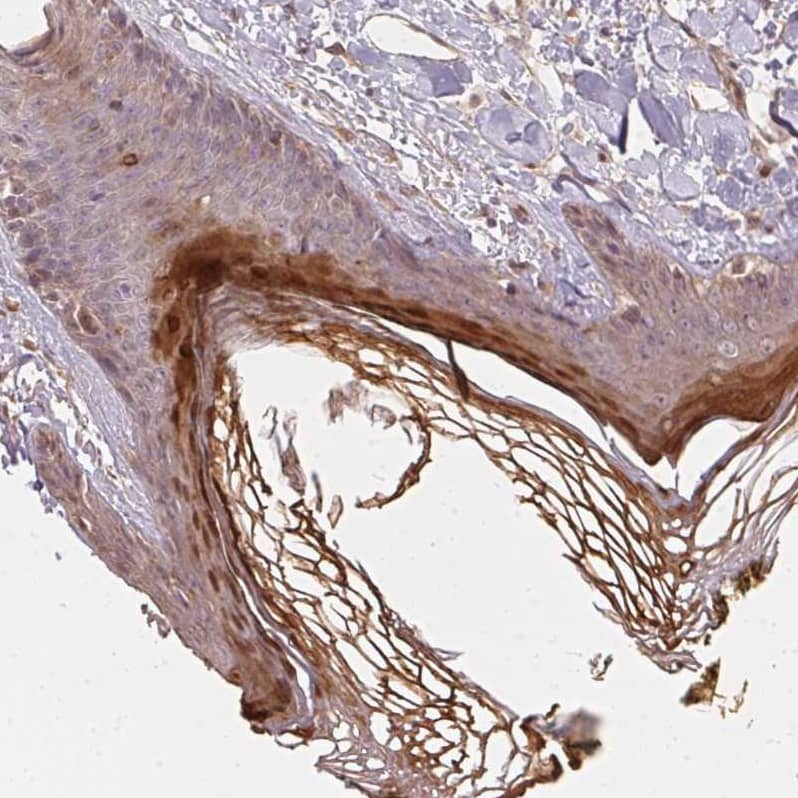 BLMH/Bleomycin Hydrolase Antibody - BSA Free Immunohistochemistry-Paraffin: BLMH/Bleomycin Hydrolase Antibody [NBP1-88640]