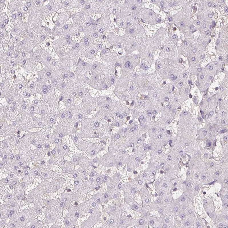 BLMH/Bleomycin Hydrolase Antibody - BSA Free Immunohistochemistry-Paraffin: BLMH/Bleomycin Hydrolase Antibody [NBP1-88640]