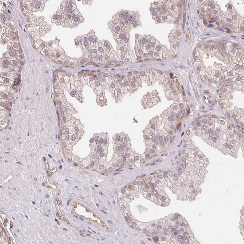 BLMH/Bleomycin Hydrolase Antibody - BSA Free Immunohistochemistry-Paraffin: BLMH/Bleomycin Hydrolase Antibody [NBP1-88640]