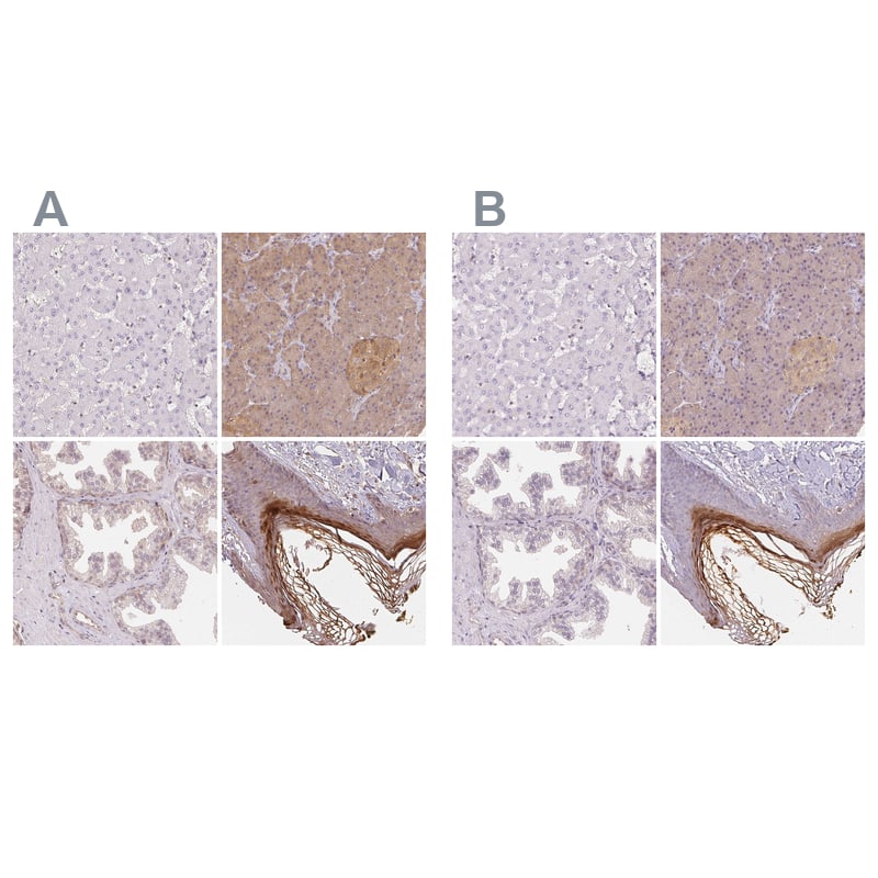 BLMH/Bleomycin Hydrolase Antibody - BSA Free Immunohistochemistry-Paraffin: BLMH/Bleomycin Hydrolase Antibody [NBP1-88640]