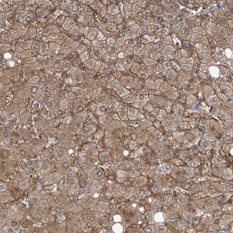 SLC6A12 Antibody - BSA Free Immunohistochemistry-Paraffin: SLC6A12 Antibody [NBP1-88641]