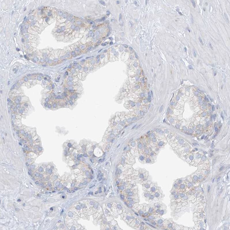 SLC6A12 Antibody - BSA Free Immunohistochemistry-Paraffin: SLC6A12 Antibody [NBP1-88641]