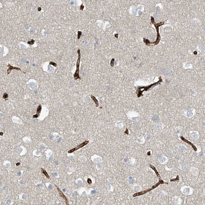 SLC6A12 Antibody - BSA Free Immunohistochemistry-Paraffin: SLC6A12 Antibody [NBP1-88641]