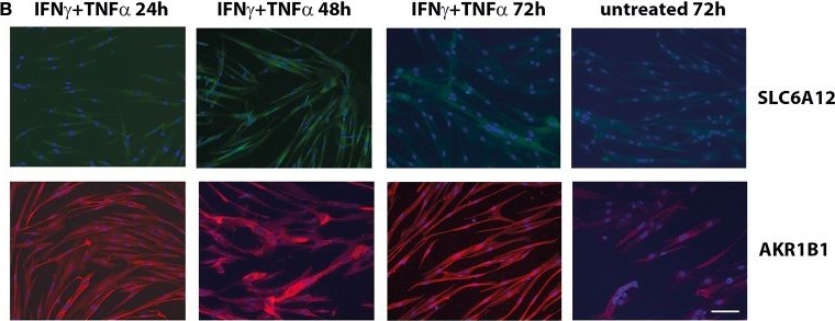 SLC6A12 Antibody - BSA Free