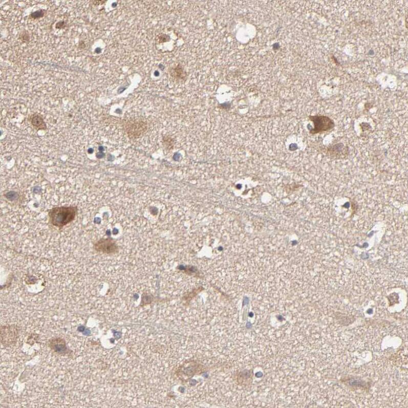 ARHGEF7 Antibody - BSA Free Immunohistochemistry-Paraffin: ARHGEF7 Antibody [NBP1-88650]