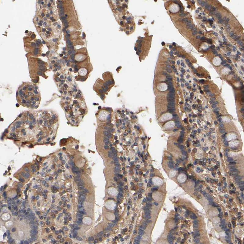 ARHGEF7 Antibody - BSA Free Immunohistochemistry-Paraffin: ARHGEF7 Antibody [NBP1-88650]