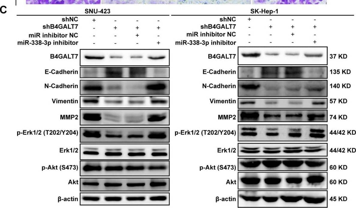 B4GALT7 Antibody - BSA Free