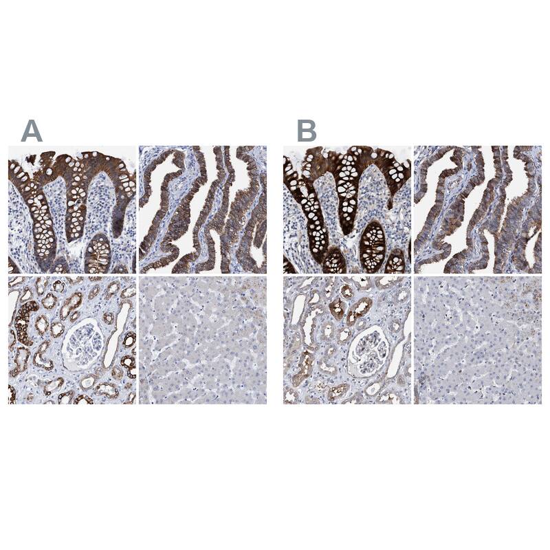 MKS1 Antibody Immunohistochemistry-Paraffin: MKS1 Antibody Antibody [NBP1-88691]