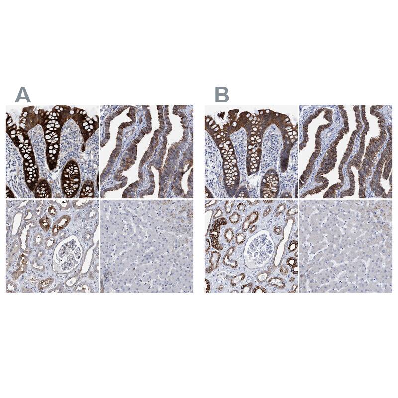 MKS1 Antibody Immunohistochemistry-Paraffin: MKS1 Antibody Antibody [NBP1-88692]