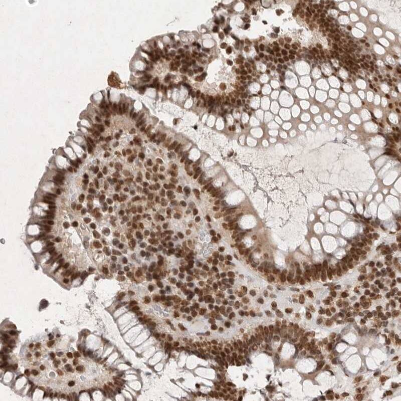 NKX3-2 Antibody - BSA Free Immunohistochemistry-Paraffin: NKX3-2 Antibody [NBP1-88708]