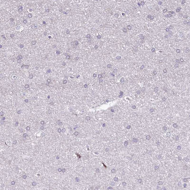 BANK1 Antibody - BSA Free Immunohistochemistry-Paraffin: BANK1 Antibody [NBP1-88714]
