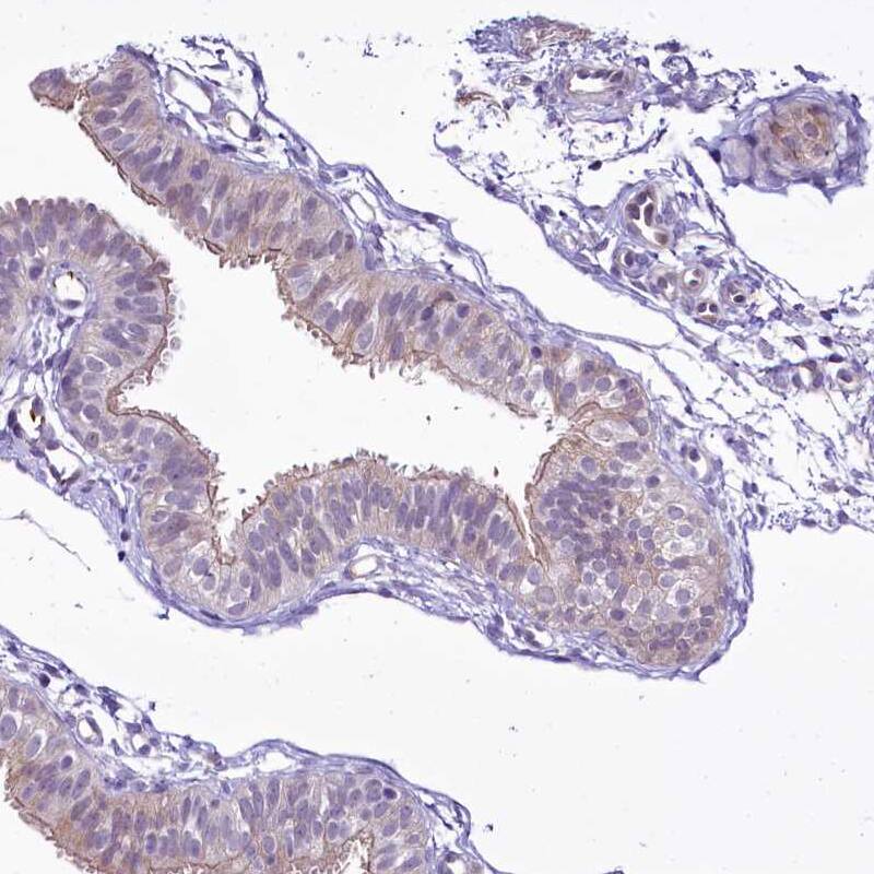 BANK1 Antibody - BSA Free Immunohistochemistry-Paraffin: BANK1 Antibody [NBP1-88714]