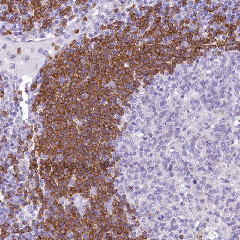 BANK1 Antibody - BSA Free Immunohistochemistry-Paraffin: BANK1 Antibody [NBP1-88714]