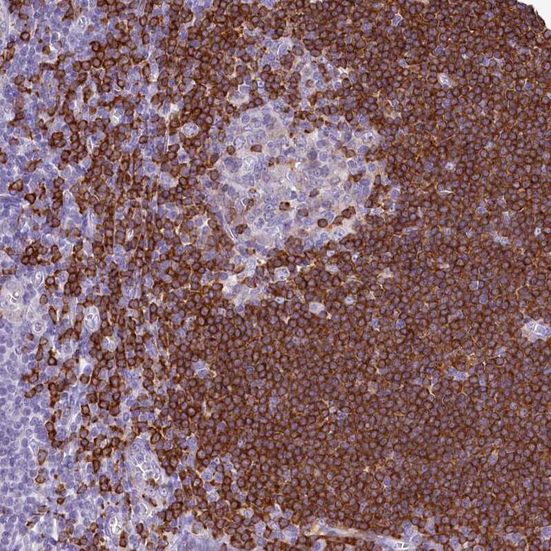 BANK1 Antibody - BSA Free Immunohistochemistry-Paraffin: BANK1 Antibody [NBP1-88714]