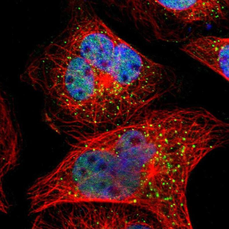 SMARCD1 Antibody - BSA Free Immunocytochemistry/ Immunofluorescence: SMARCD1 Antibody [NBP1-88719]