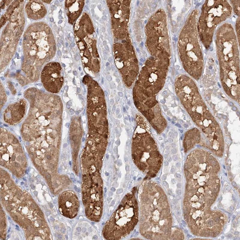 SFRS18 Antibody - BSA Free Immunohistochemistry-Paraffin: SFRS18 Antibody [NBP1-88723]