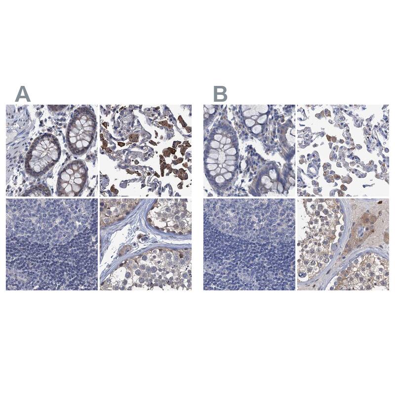 RTKN2 Antibody Immunohistochemistry-Paraffin: RTKN2 Antibody Antibody [NBP1-88748]