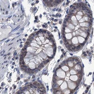 RTKN2 Antibody Immunohistochemistry-Paraffin: RTKN2 Antibody [NBP1-88748]