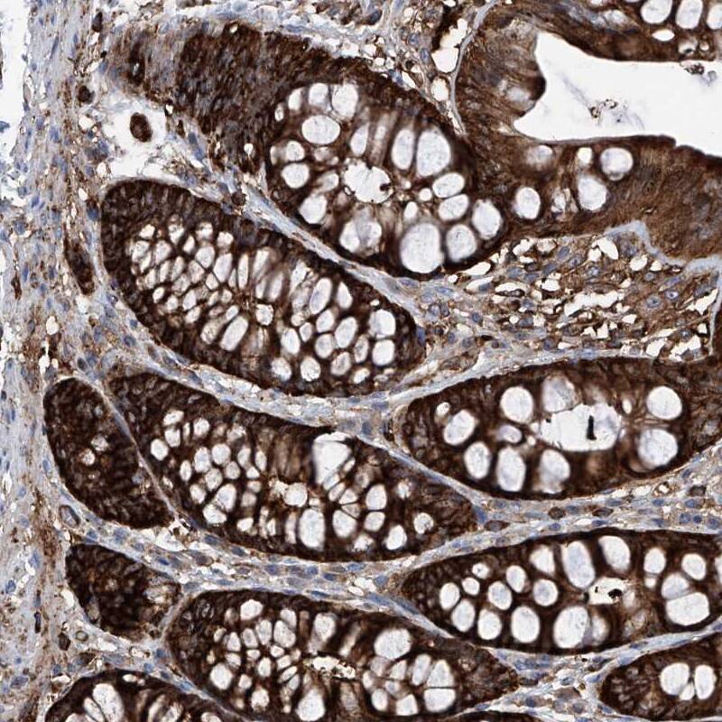 ZNF484 Antibody - BSA Free Immunohistochemistry-Paraffin: ZNF484 Antibody [NBP1-88750]