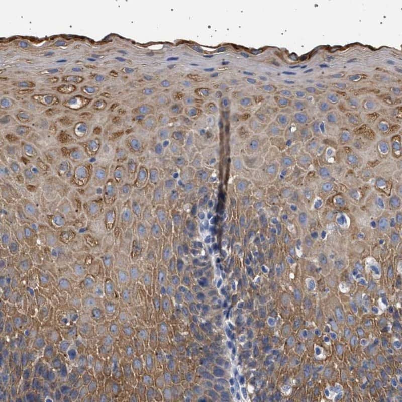 RG9MTD3 Antibody - BSA Free Immunohistochemistry-Paraffin: RG9MTD3 Antibody [NBP1-88770]