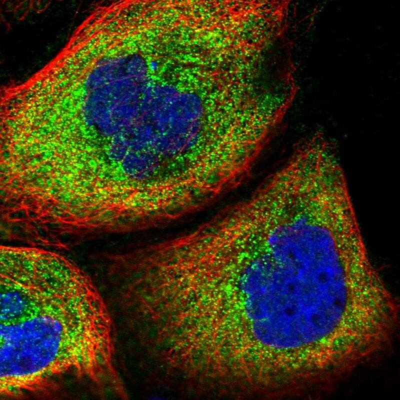 WDR34 Antibody - BSA Free Immunocytochemistry/ Immunofluorescence: WDR34 Antibody [NBP1-88806]