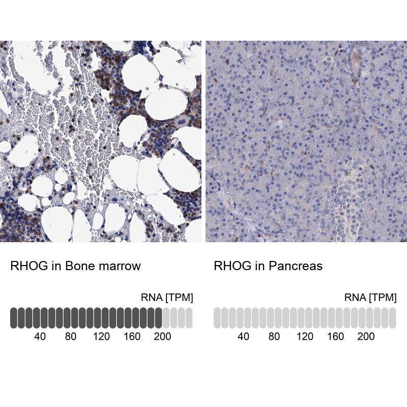 RhoG Antibody - BSA Free Immunohistochemistry-Paraffin: RhoG Antibody [NBP1-88832]