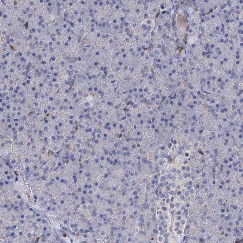 RhoG Antibody - BSA Free Immunohistochemistry-Paraffin: RhoG Antibody [NBP1-88832]
