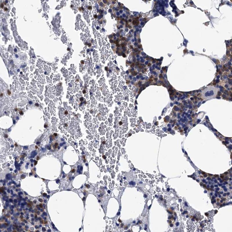 RhoG Antibody - BSA Free Immunohistochemistry-Paraffin: RhoG Antibody [NBP1-88832]