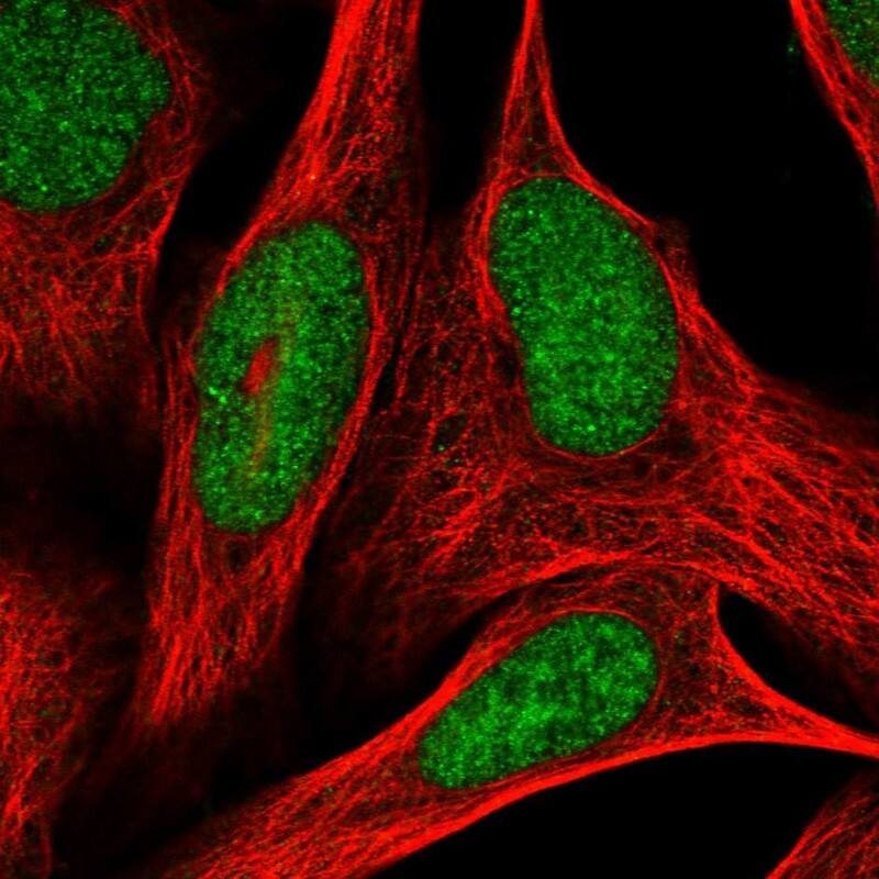 ADPRHL2 Antibody - BSA Free Immunocytochemistry/ Immunofluorescence: ADPRHL2 Antibody [NBP1-88834]
