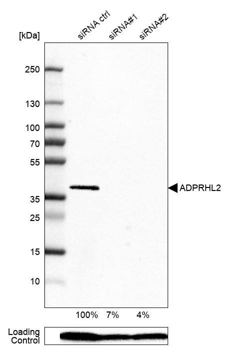 ADPRHL2 Antibody Western Blot: ADPRHL2 Antibody [NBP1-88835] -