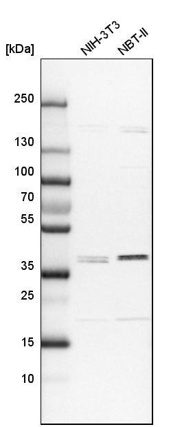 ADPRHL2 Antibody Western Blot: ADPRHL2 Antibody [NBP1-88835] -