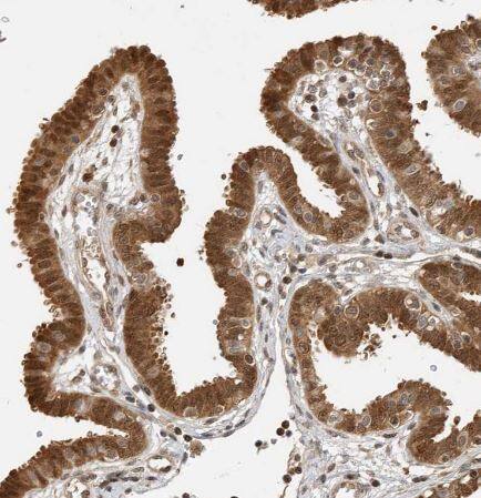 ADPRHL2 Antibody ADPRHL2 Antibody