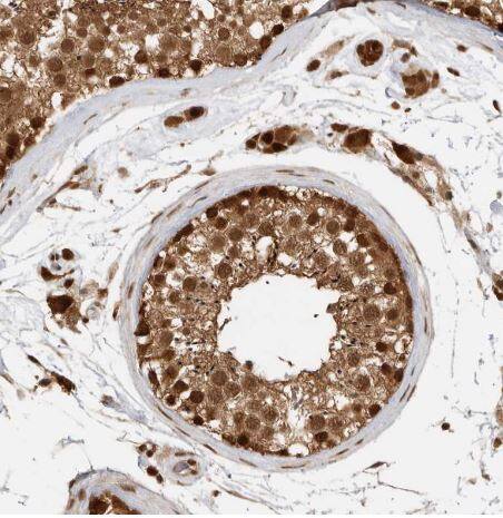 ADPRHL2 Antibody ADPRHL2 Antibody