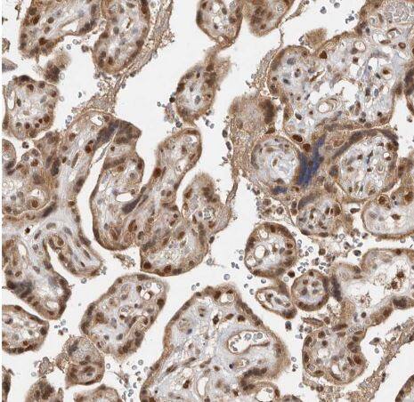 ADPRHL2 Antibody ADPRHL2 Antibody