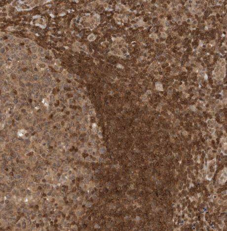 ADPRHL2 Antibody ADPRHL2 Antibody