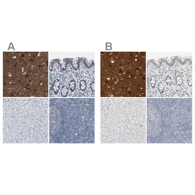 RTN3 Antibody Immunohistochemistry-Paraffin: RTN3 Antibody Antibody [NBP1-88870]