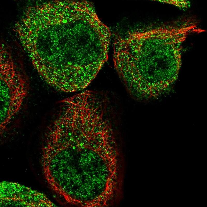 WIPI2 Antibody - BSA Free Immunocytochemistry/ Immunofluorescence: WIPI2 Antibody [NBP1-88879]