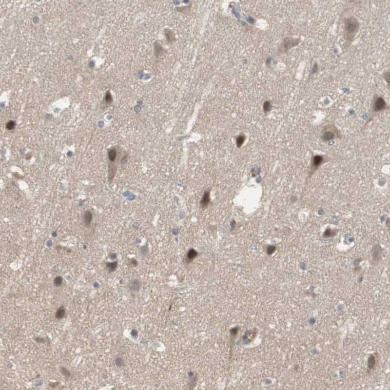 SNX4 Antibody - BSA Free Immunohistochemistry-Paraffin: SNX4 Antibody [NBP1-88882]