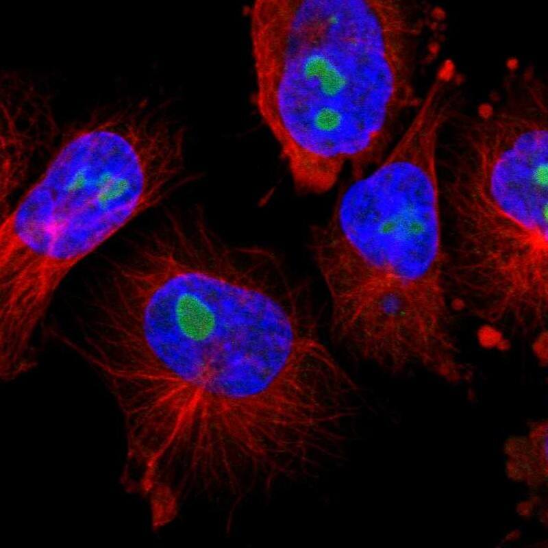 TNFAIP1 Antibody - BSA Free Immunocytochemistry/ Immunofluorescence: TNFAIP1 Antibody [NBP1-88930]