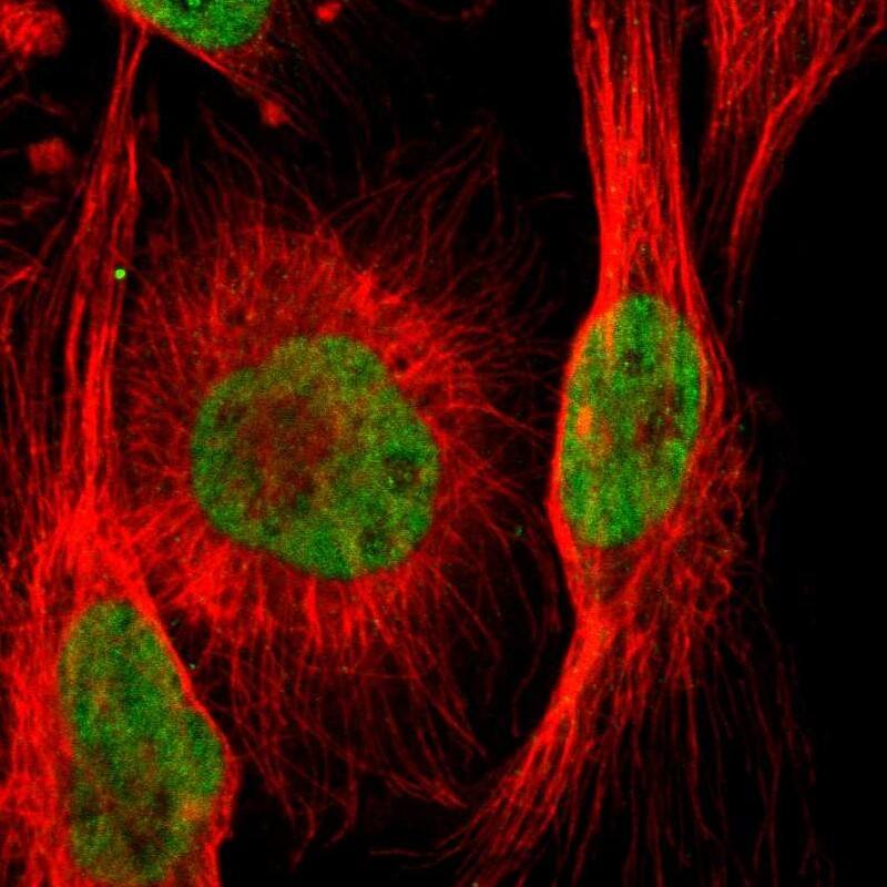 ARID1A Antibody - BSA Free Immunocytochemistry/ Immunofluorescence: ARID1A Antibody [NBP1-88932]