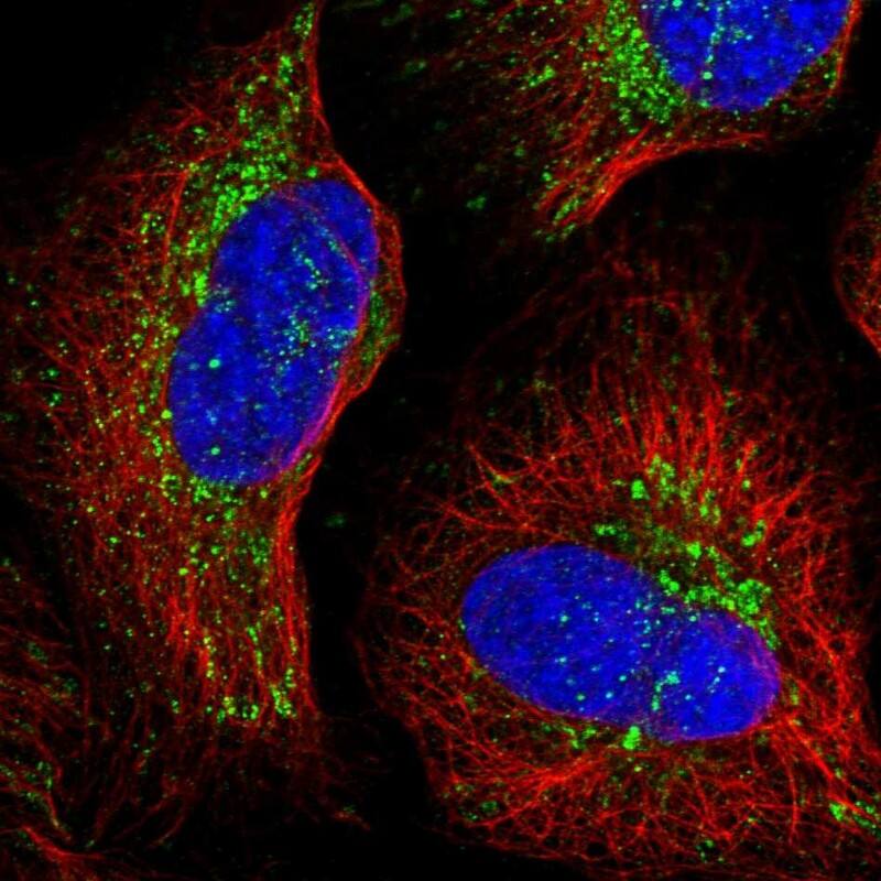 NDUFA12 Antibody - BSA Free Immunocytochemistry/ Immunofluorescence: NDUFA12 Antibody [NBP1-88935]