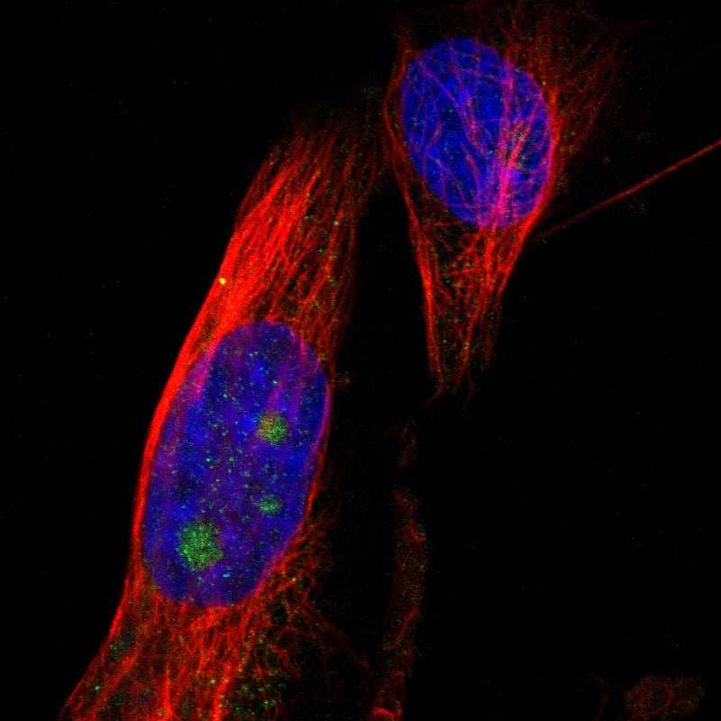B3GNT5 Antibody - BSA Free Immunocytochemistry/ Immunofluorescence: B3GNT5 Antibody [NBP1-88954]