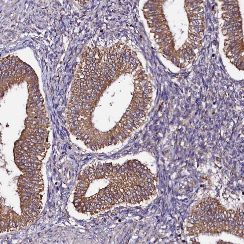 UFM1 Antibody - BSA Free Immunohistochemistry-Paraffin: UFM1 Antibody [NBP1-88977]
